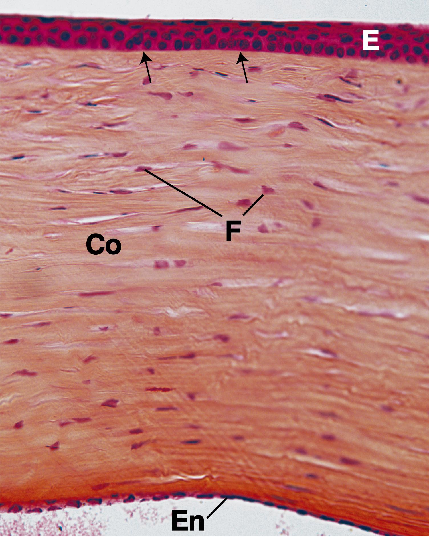 Fig. 22.8, At medium magnification, the stratified squamous epithelium (E) of the cornea is well demonstrated, as is the thin acellular Bowman membrane (arrows) that separates the epithelium from the transparent stroma with its collagen fibers (Co) and thin fibroblasts (F). Note the thin simple squamous to cuboidal endothelium (En) that separates the cornea from the aqueous humor of the anterior chamber. (×270)