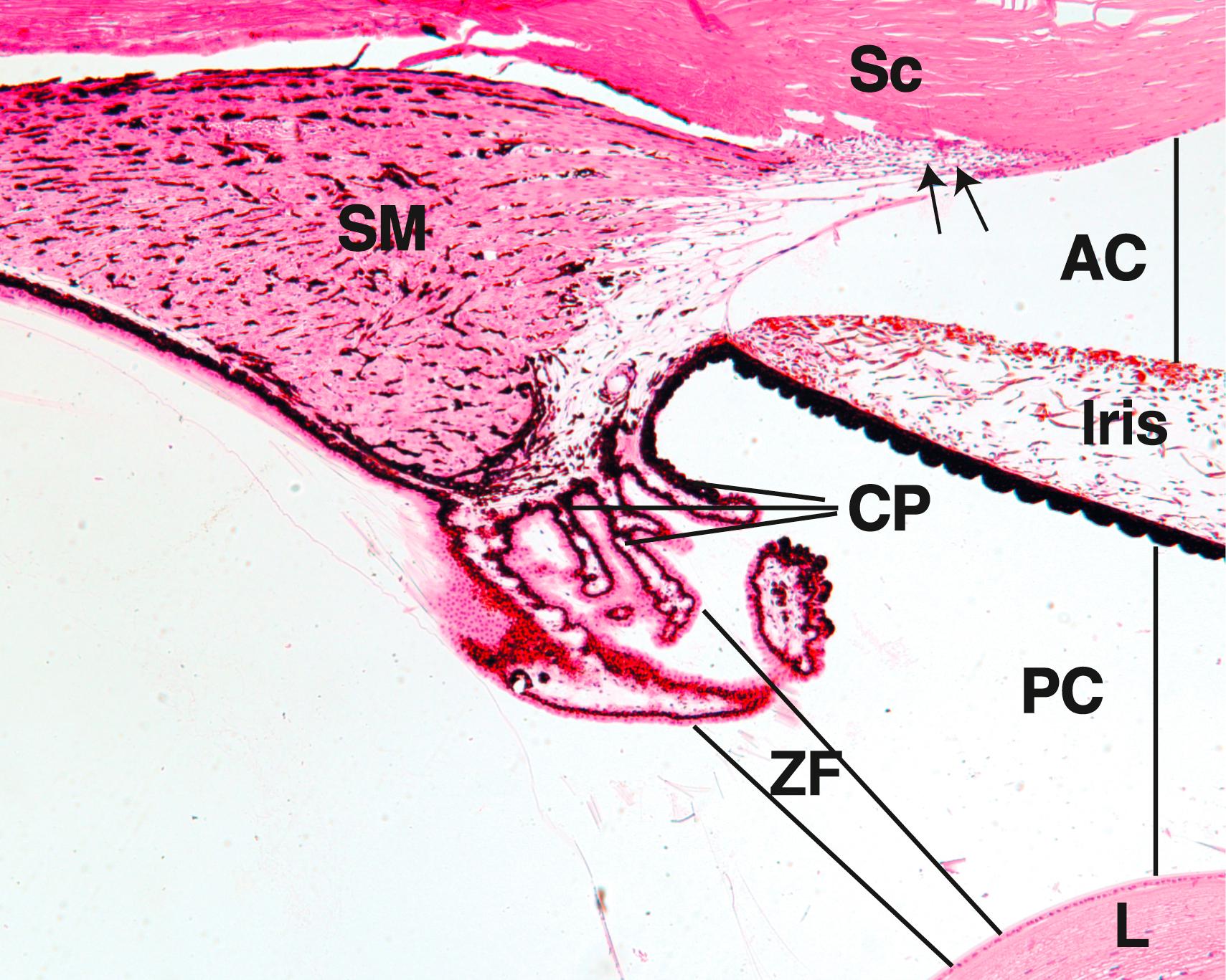 Fig. 22.9, This low-magnification photomicrograph presents the smooth muscle (SM) of the ciliary body and the ciliary processes (CP), as well as the proximal portion of the iris that separates the anterior chamber (AC) from the posterior chamber (PC) located between the iris and the lens (L). The lines drawn from the ciliary processes to the lens represent the zonular fibers (ZF). Observe the canal of Schlemm (arrows) at the junction of the sclera–corneal junction (Sc). (×132)