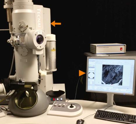 Fig. 2.14, Transmission electron microscope ( arrow ) with electronic image capture ( arrowhead ).