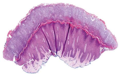 Fig. 2.4, Technical artifact: folds in tissue sections because of poor bath floating technique.