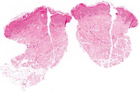 Fig. 2.6, Technical artifact: vertical scores in tissue sections caused by a damaged microtome blade.