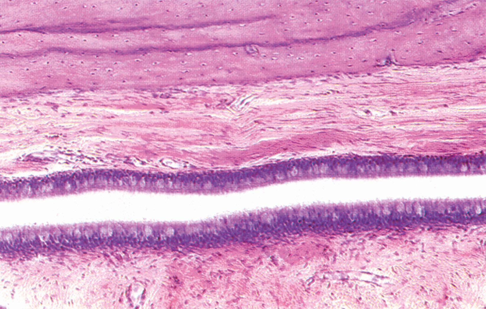 Fig. 21.23, Auditory (Eustachian) canal