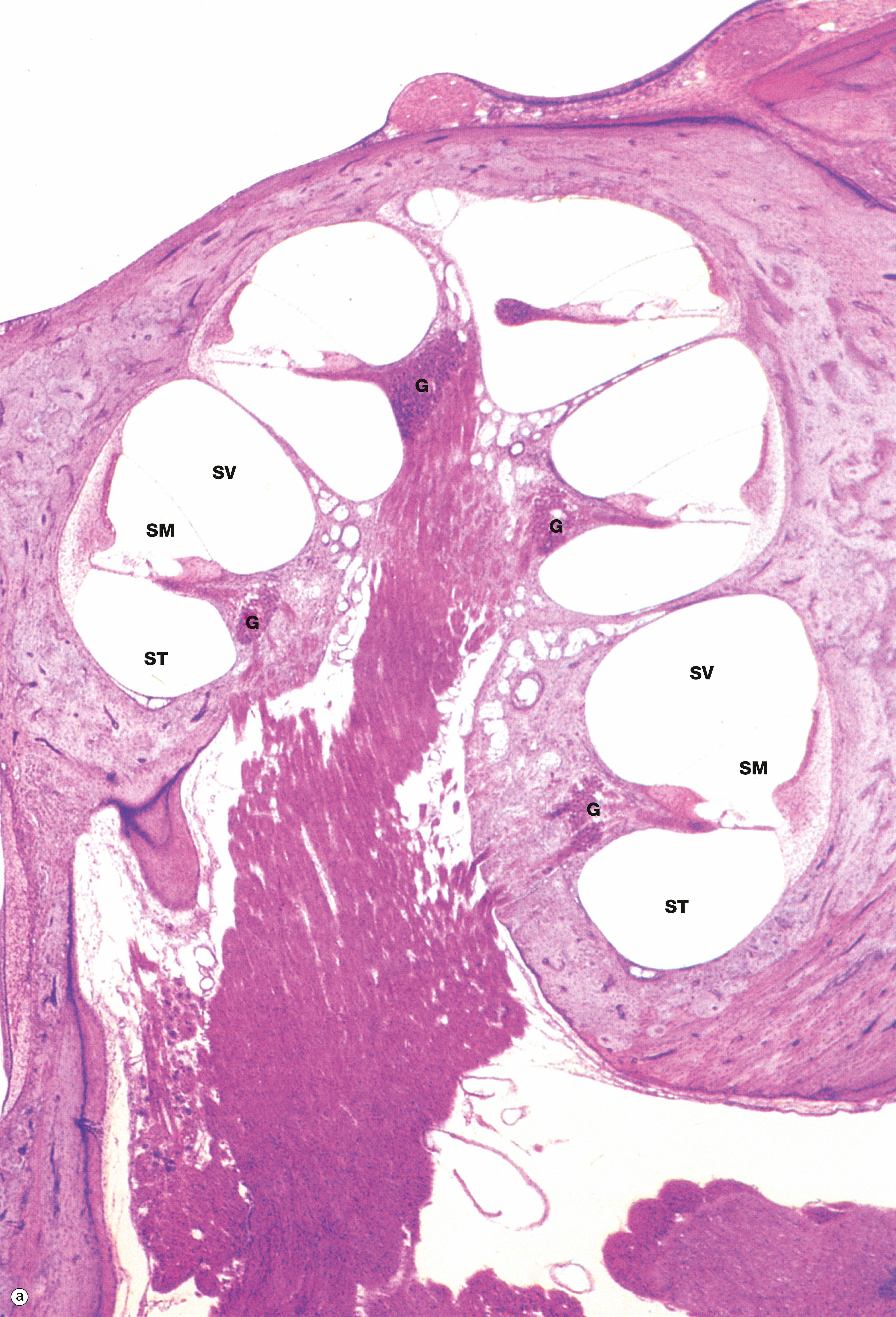 Fig. 21.24, Cochlea