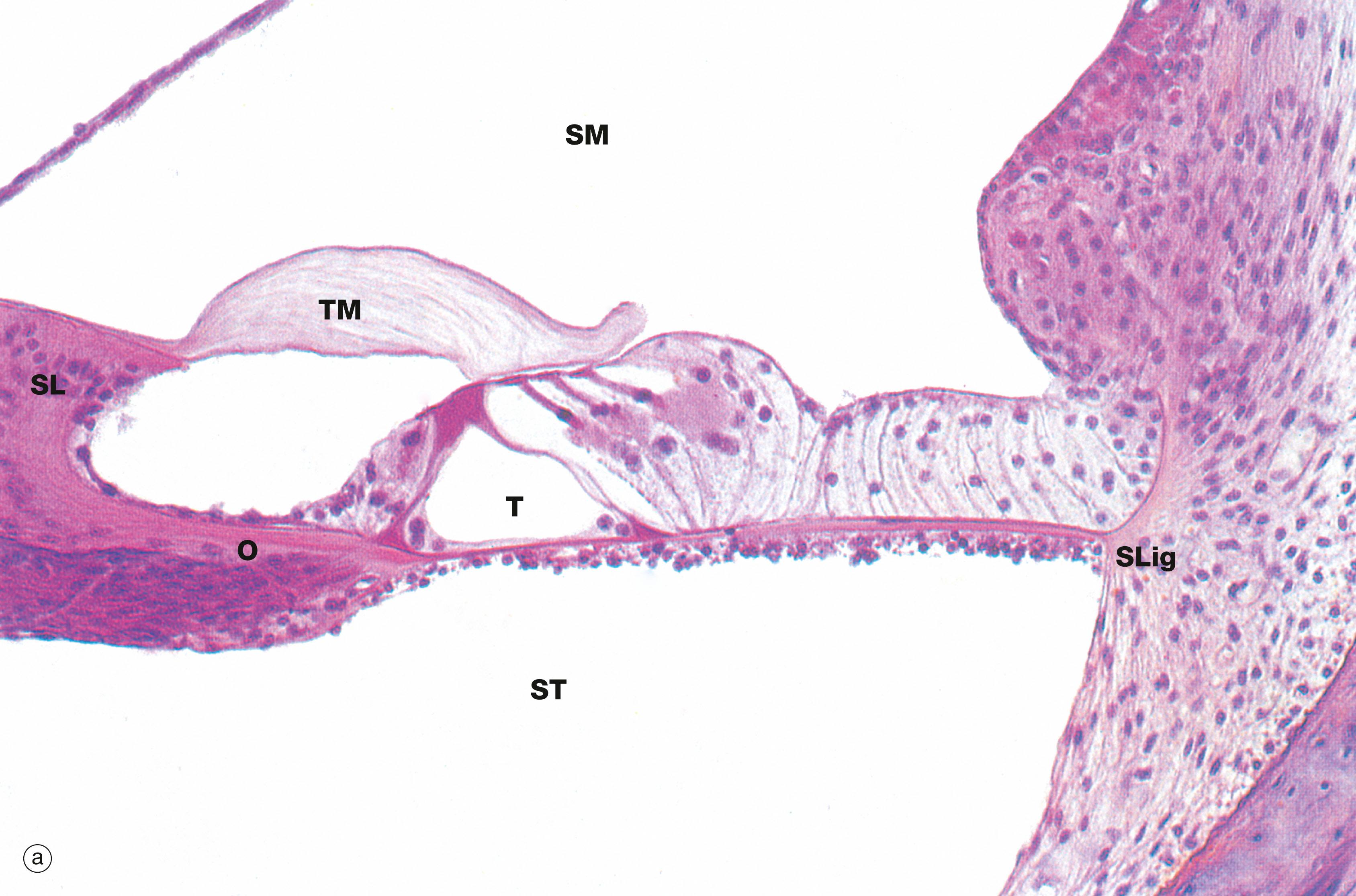 Fig. 21.25, Organ of Corti