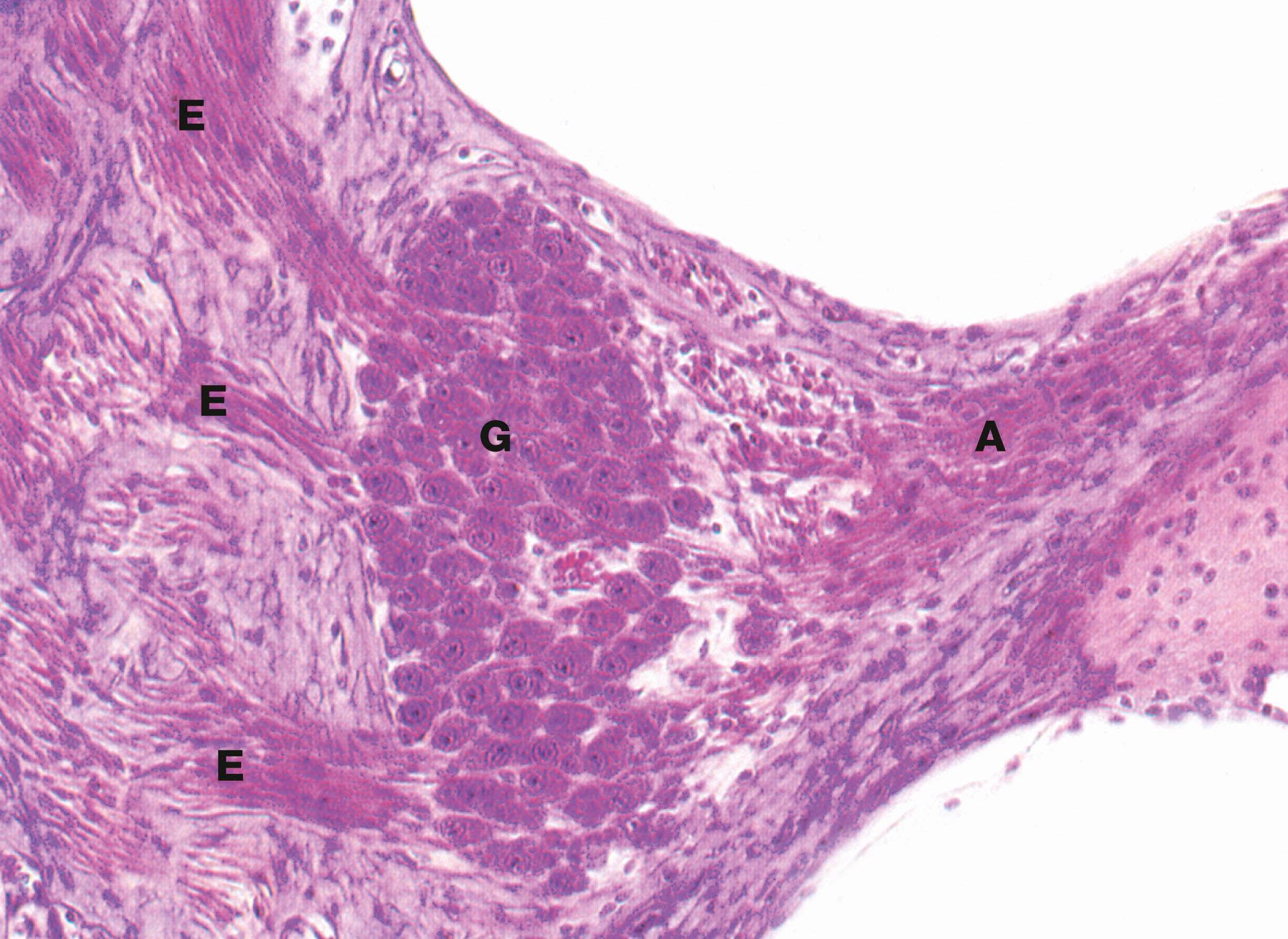 Fig. 21.26, Spiral ganglion