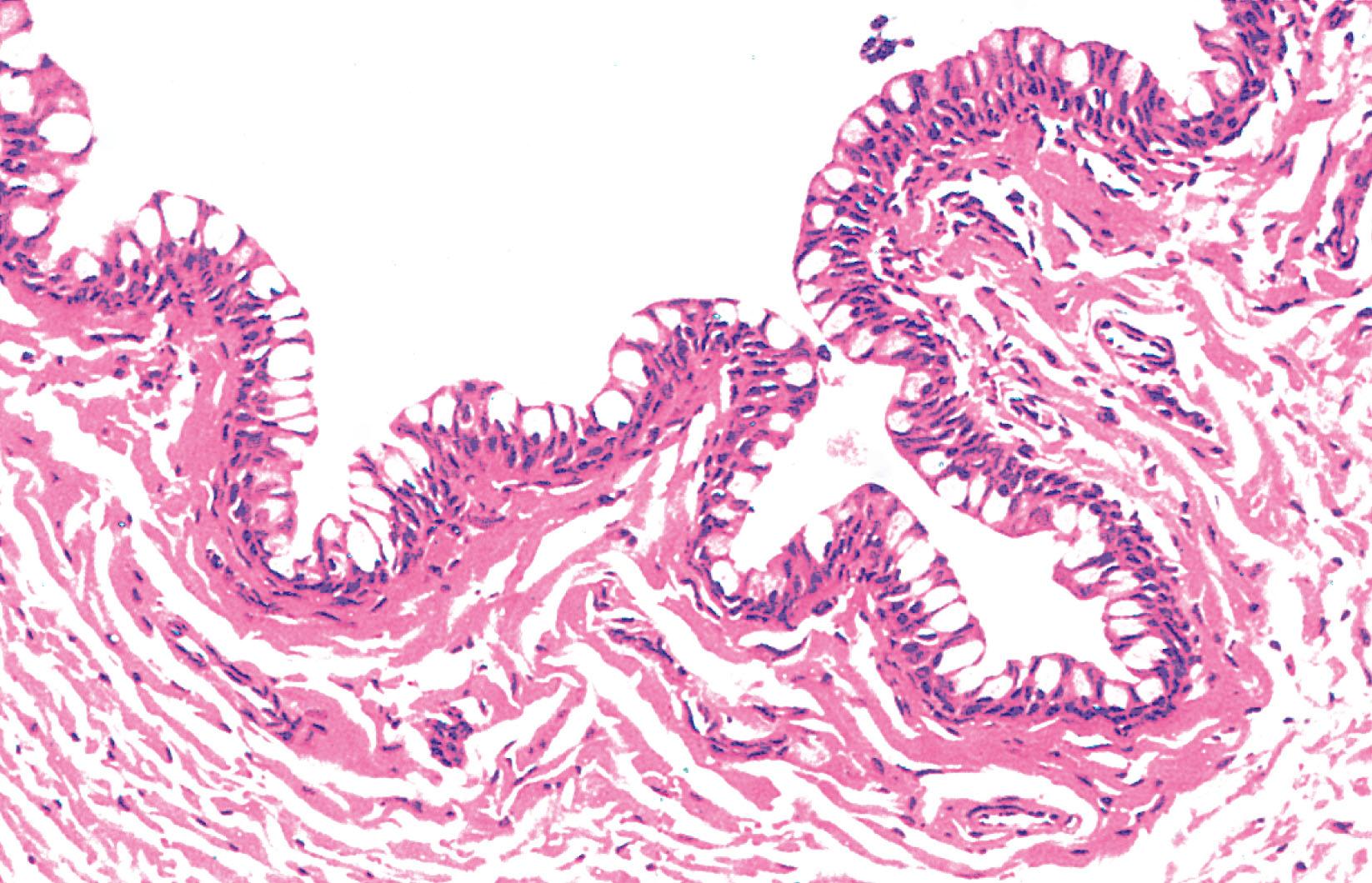 Fig. 21.16, Conjunctiva