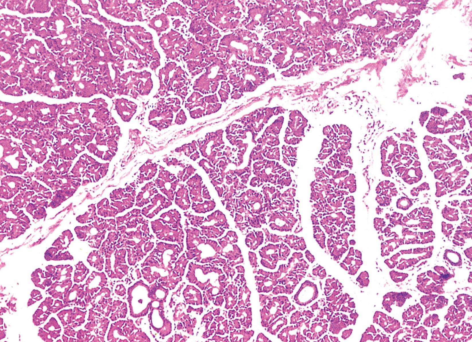 Fig. 21.17, Lacrimal gland