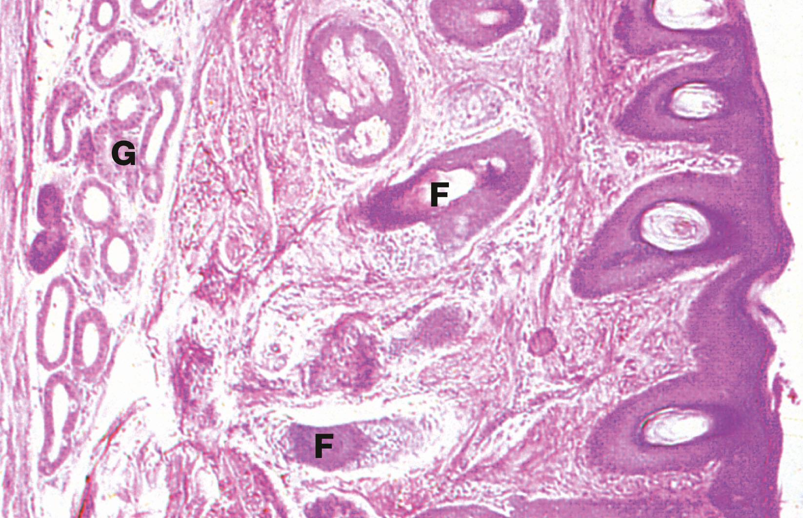 Fig. 21.21, External auditory meatus