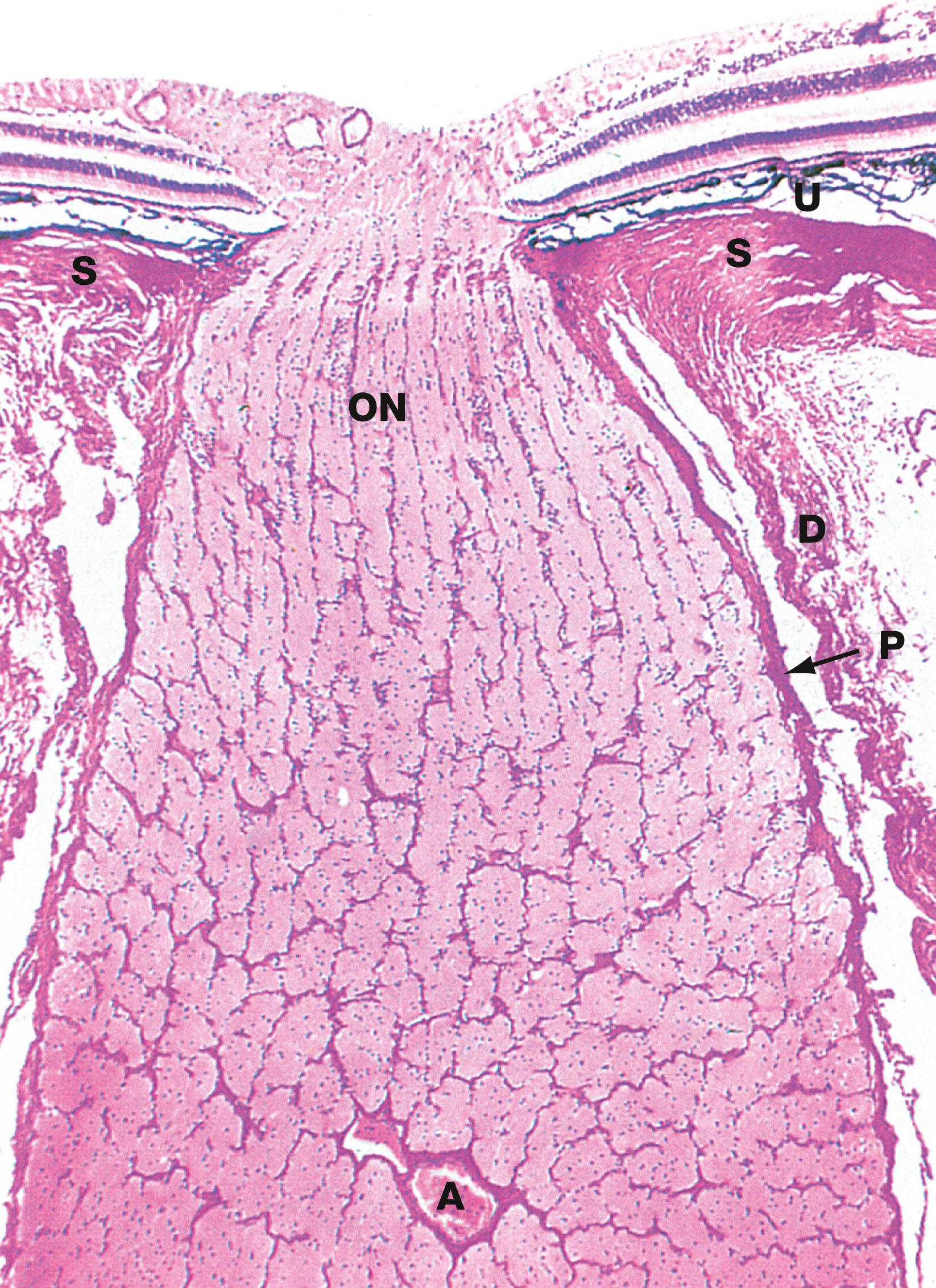 Fig. 21.10, Optic nerve