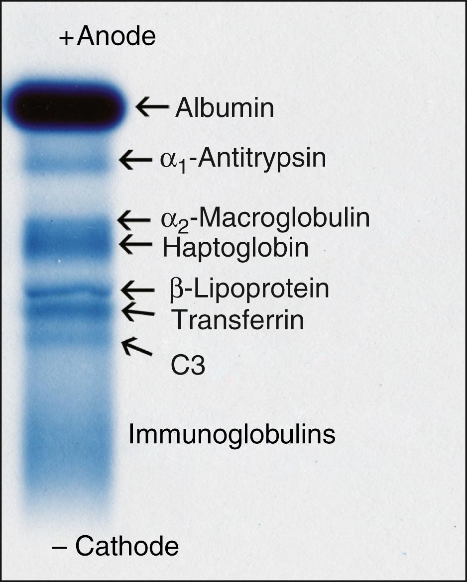 Figure 20.1, Positions of major serum proteins in a normal person using electrophoresis in agarose. Individual proteins separate according to their electrical charge between the anode (positive pole) and the cathode (negative pole).