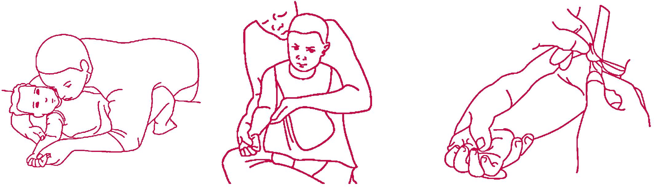 FIGURE 4.1, Holding a child for venipuncture.