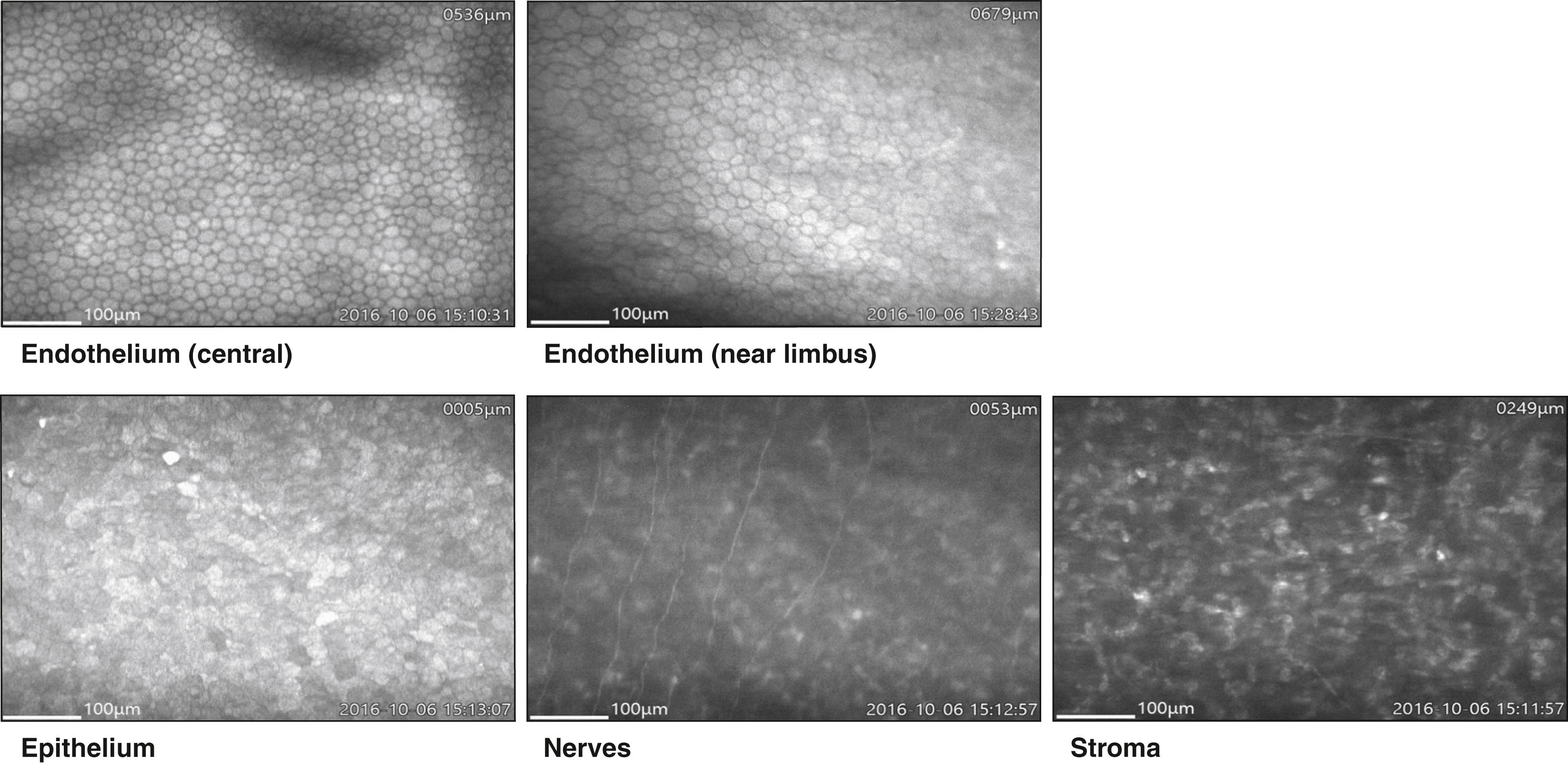 Fig. 13.4, Wide-field images of normal central and near limbus endothelium, epithelium, nerves, and stroma acquired with the Konan Cell Chek C.
