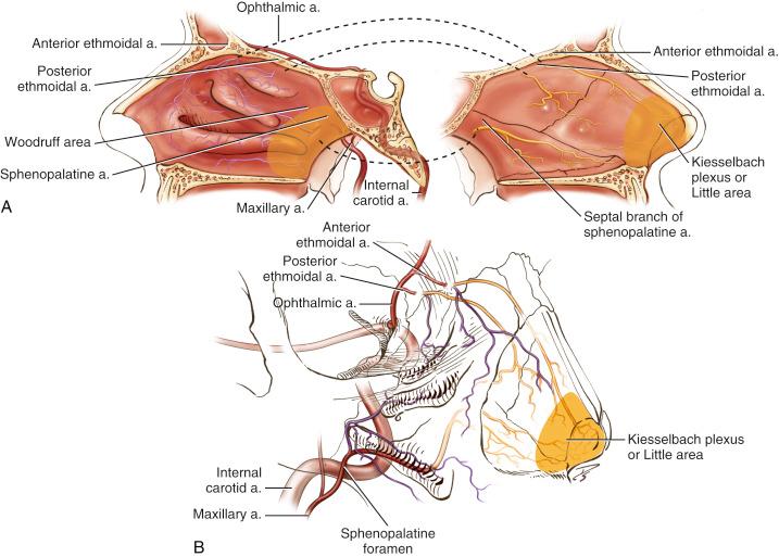 Fig. 3.1, (A) Drawing of the vascular supply of the nasal septum. Note that the sagittal cuts are as if the patient’s right nose had been opened like a book. The anterior and posterior ethmoid arteries arise from the ophthalmic artery and perfuse the superior septum and lateral nasal wall. The sphenopalatine artery, which comes off the internal maxillary artery, perfuses most of the lateral nasal wall and septal mucosa. The septal branch of the sphenopalatine artery crosses from the lateral nasal wall to the septum just under the sphenoid sinus ostium. (B) Drawing showing three-quarter view of the blood supply of the nose. The contents of the orbit are treated as if transparent. The ophthalmic artery enters through the optic canal and sends branches of the posterior and anterior ethmoid arteries to supply the superior portions of the nasal cavity. a., Artery.