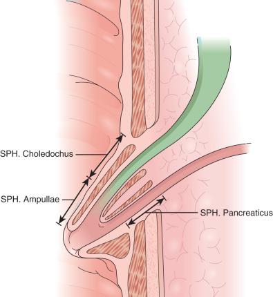 FIG 56.1, The sphincter of Oddi. SPH, sphincter.