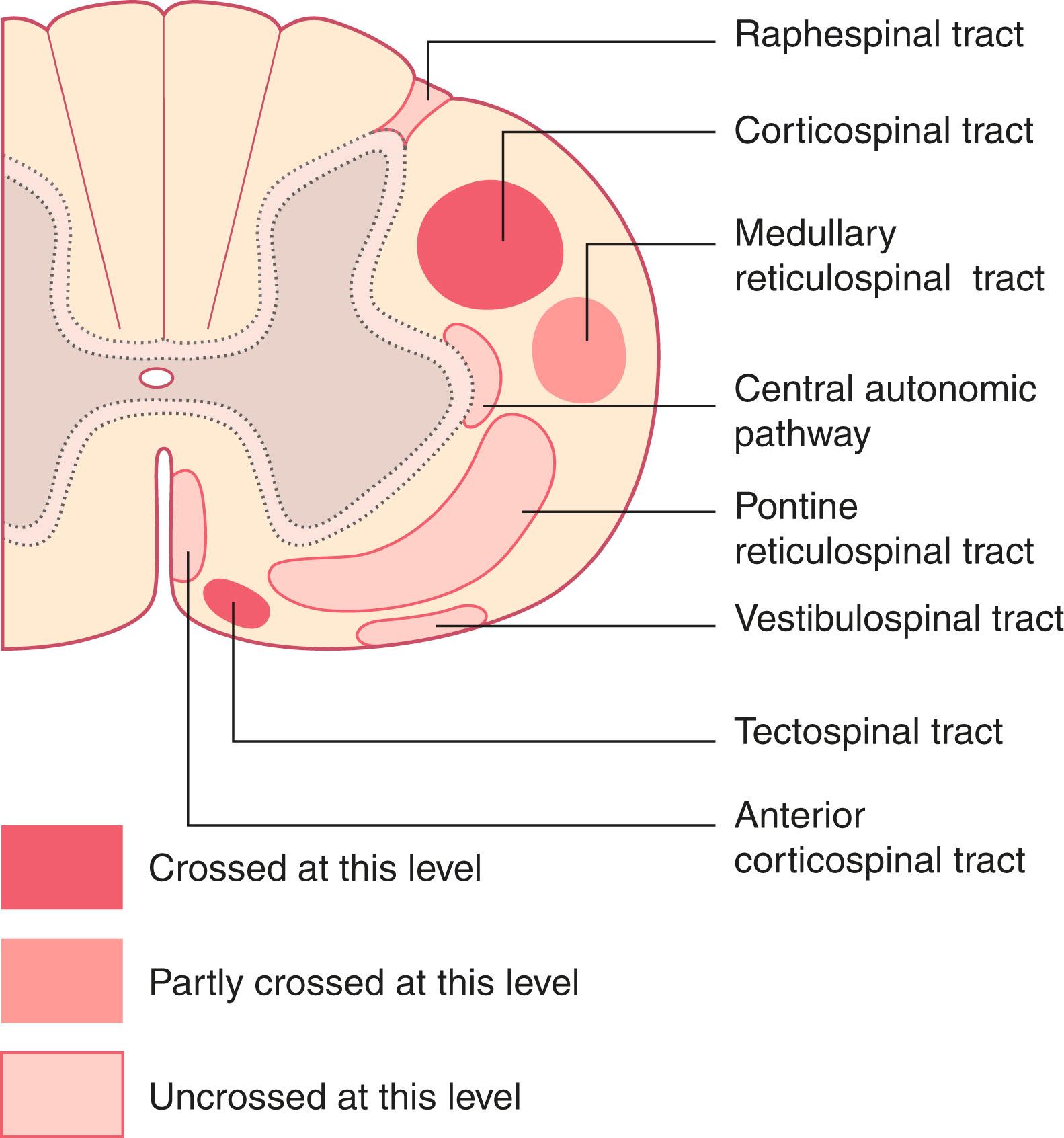 Fig. 16.7, Descending pathways at the upper cervical level. Notes: The ventral corticospinal tract/anterior corticospinal tract crosses partially at the lower cervical level and engages ventral horn cells supplying postural muscles of the trunk. Some 10% of corticospinal tract fibres descend ipsilaterally.