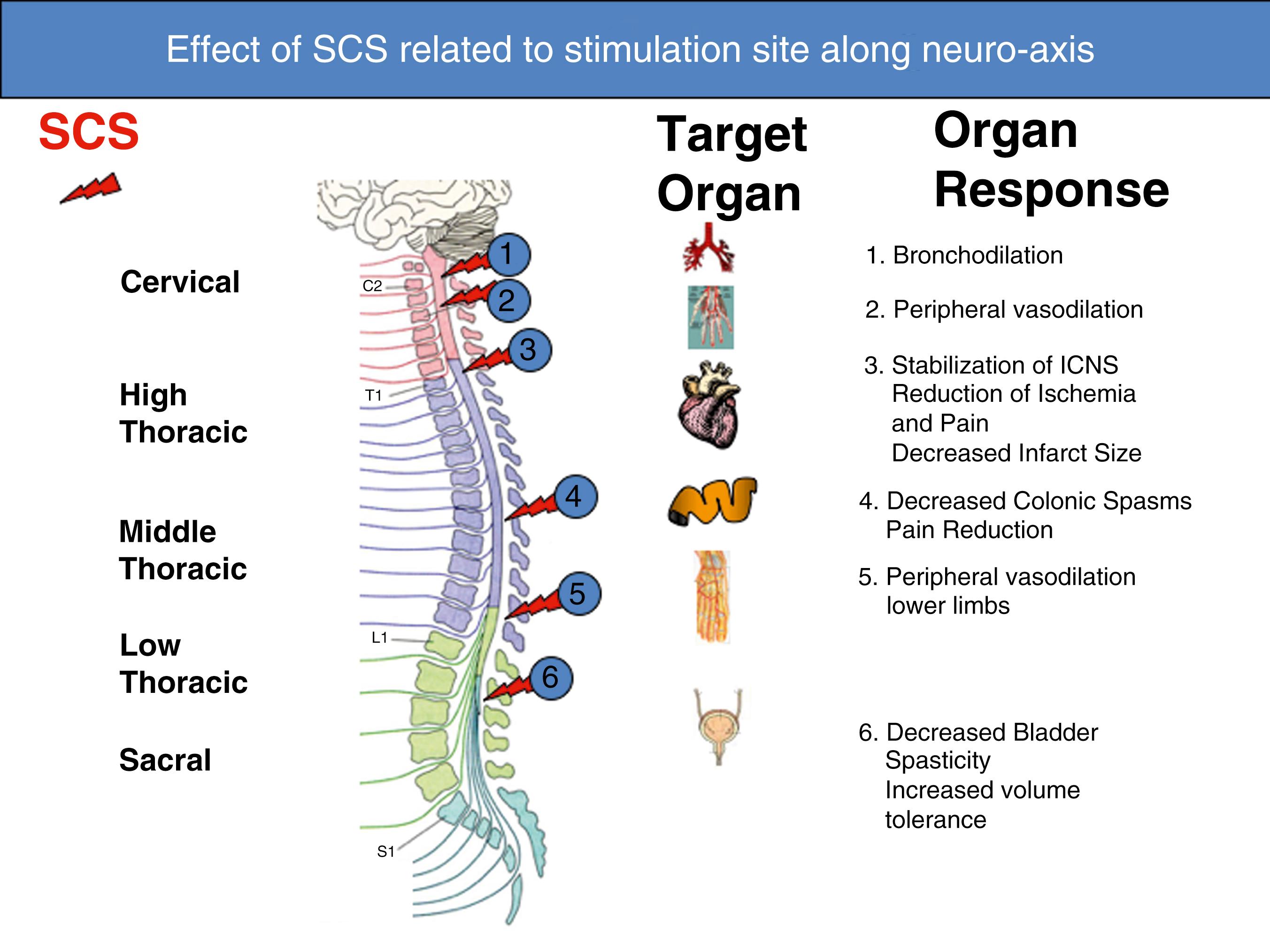 FIGURE 119.2, This figure illustrates how SCS applied to different regions of the spinal cord, besides the effect on neuropathic pain, also induces changes in the function of different target organs via local autonomic activity changes, dorsal root reflexes and viscero-somatic reflexes. The numbers on the lightning bolts refer to numbers on the organ responses to the right of the figure.