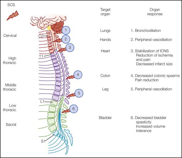 Figure 41-1, Effects of spinal cord stimulation (SCS) applied at different sites along the neuraxis.