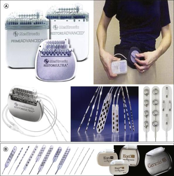 Figure 41-5, Examples of electrodes and implantable pulse generators (IPGs).