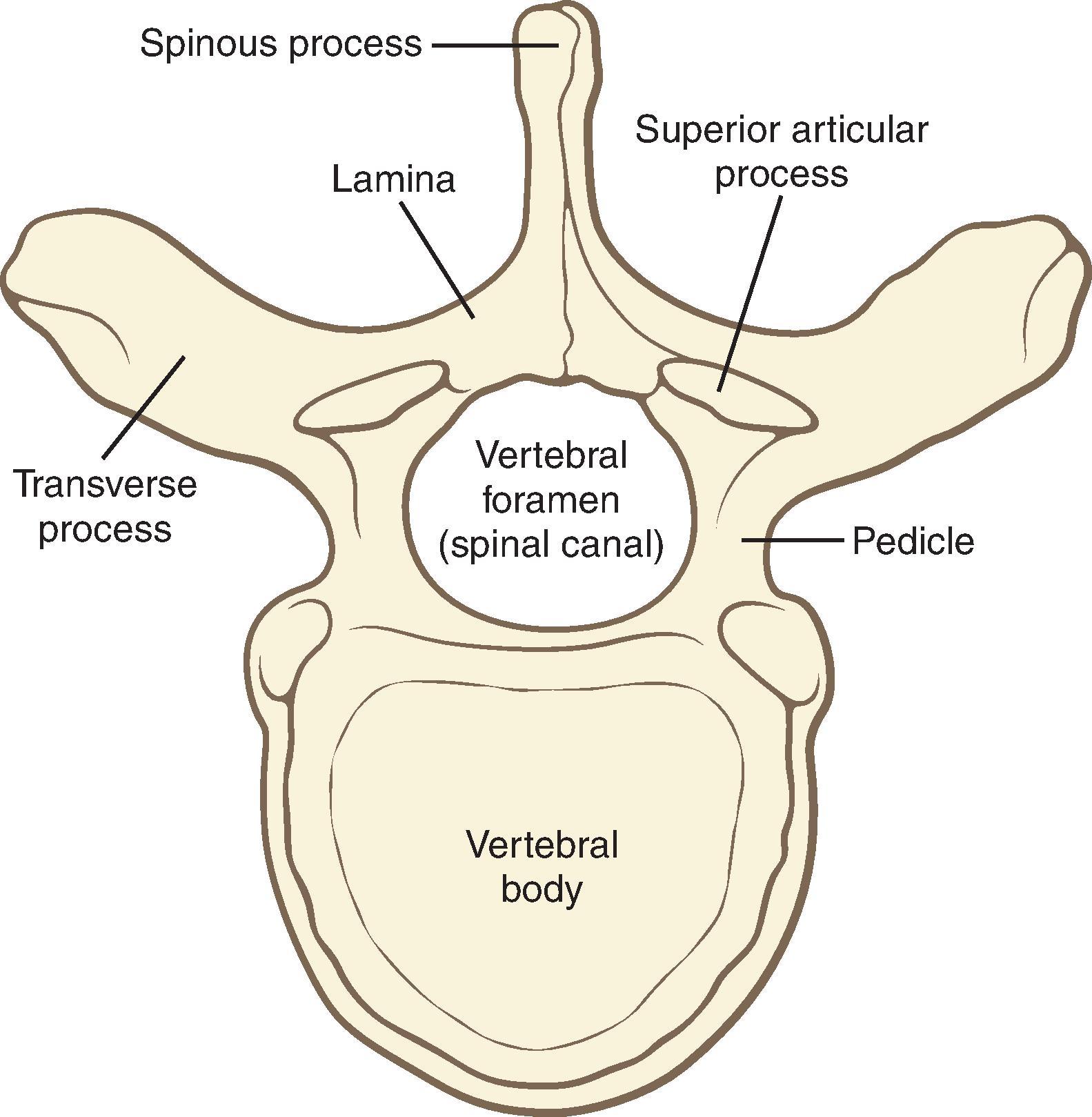 Fig. 17.4, Typical thoracic vertebra. (From Covino BG, Scott DB, Lambert DH. Handbook of Spinal Anaesthesia and Analgesia. Philadelphia: WB Saunders; 1994.)