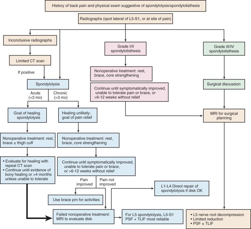 Fig. 140.7, A treatment algorithm for spondylolysis/spondylolisthesis. CT, Computed tomography; MRI, magnetic resonance imaging; prn, as needed; PSF, posterior spinal fusion; TLIF, transforaminal lumbar interbody fusion.