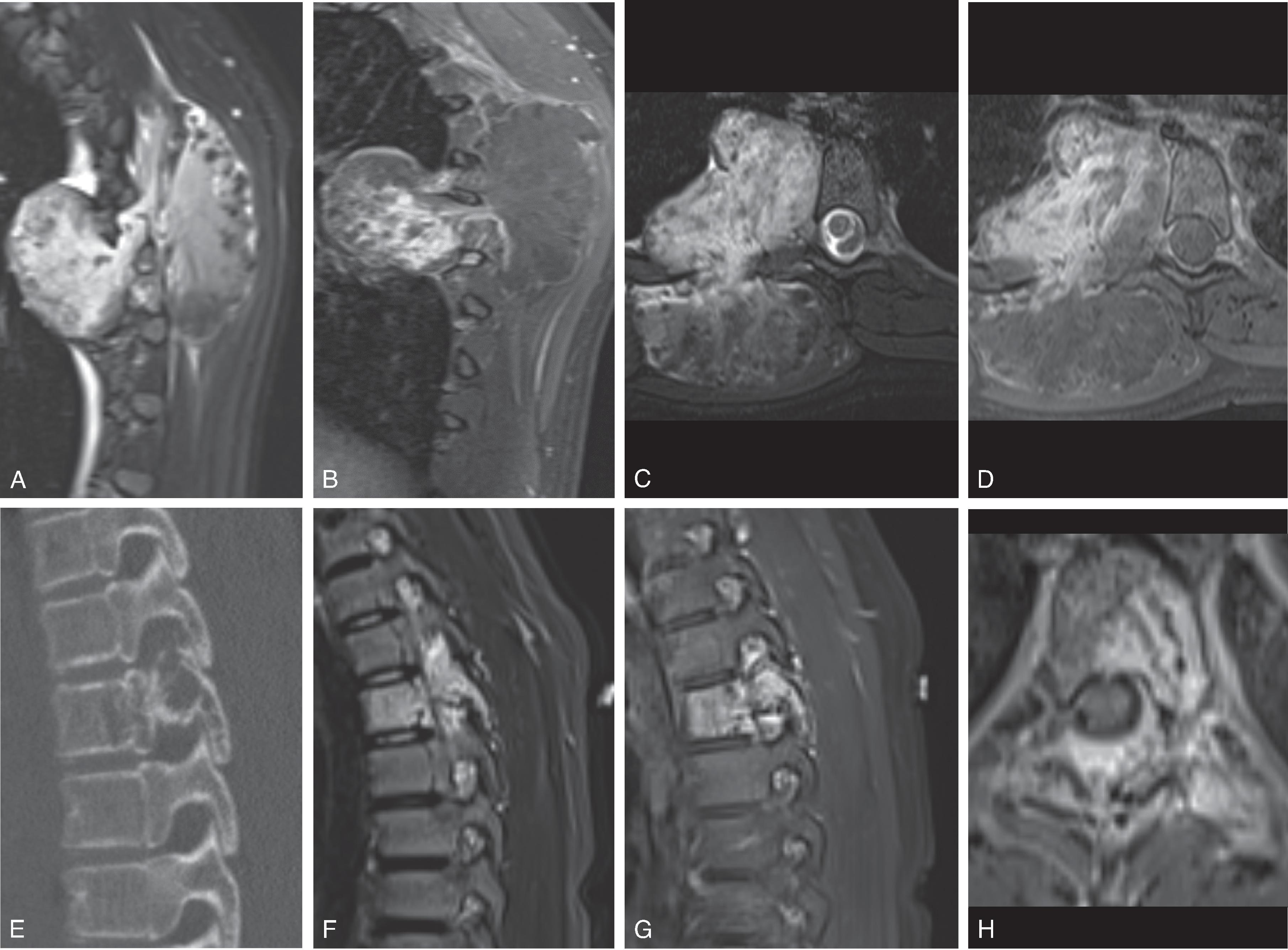 Fig. 17.18, Vascular Malformations.