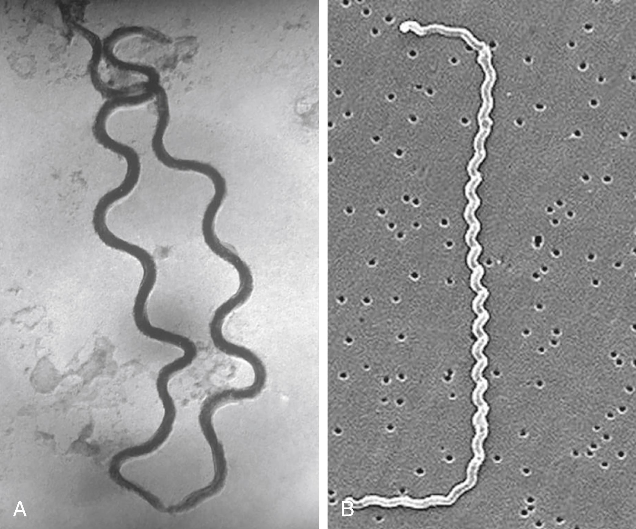 Fig. 61.1, Electron photomicrographs of pathogenic spirochetes. A Two spiral-shaped Treponema pallidum bacteria (36,000×). B Leptospira interrogans strain RGA bound to a 0.2-μm filter.