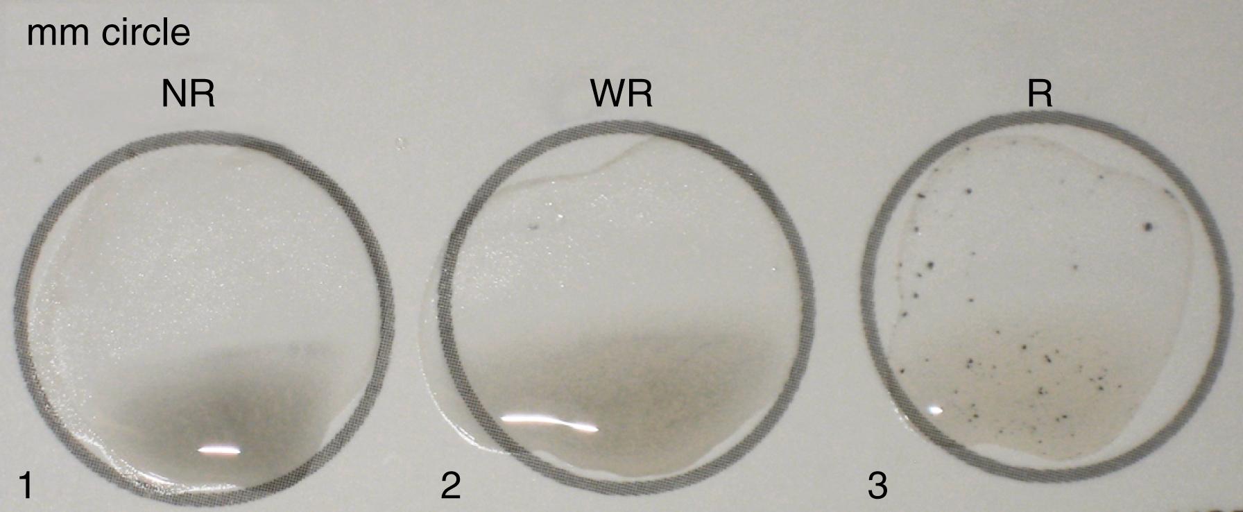 Fig. 61.6, Rapid plasmin reagin test card showing nonreactive, weakly reactive, and strongly reactive serum samples (wells 1 to 3) with their respective agglutination patterns.