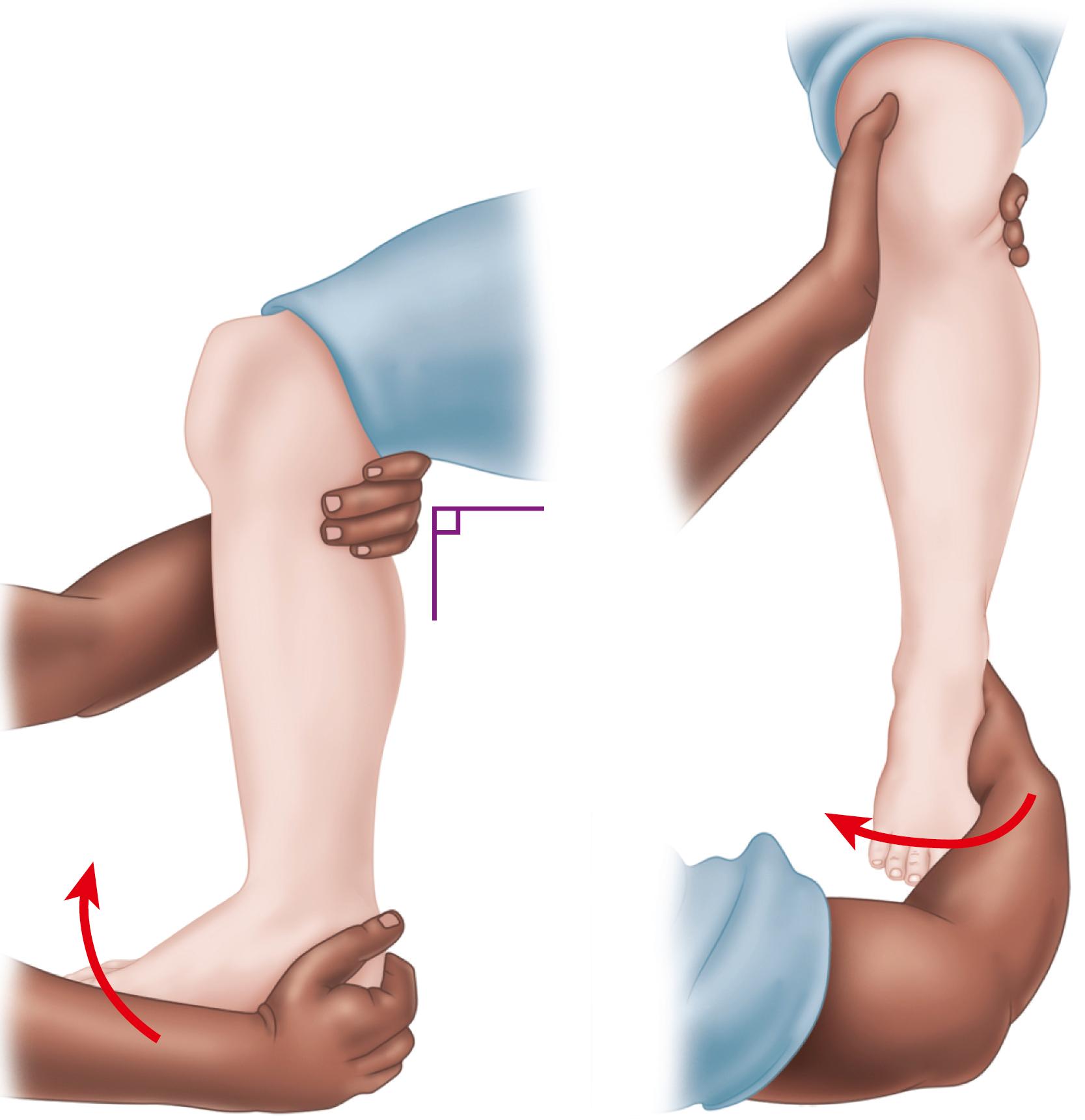 FIGURE 90.13, External rotation testing is performed by applying external rotation stress to involved foot and ankle while knee is held in 90 degrees of flexion and ankle is in neutral position. Positive test produces pain over anterior or posterior tibiofibular ligaments and over interosseous membrane.
