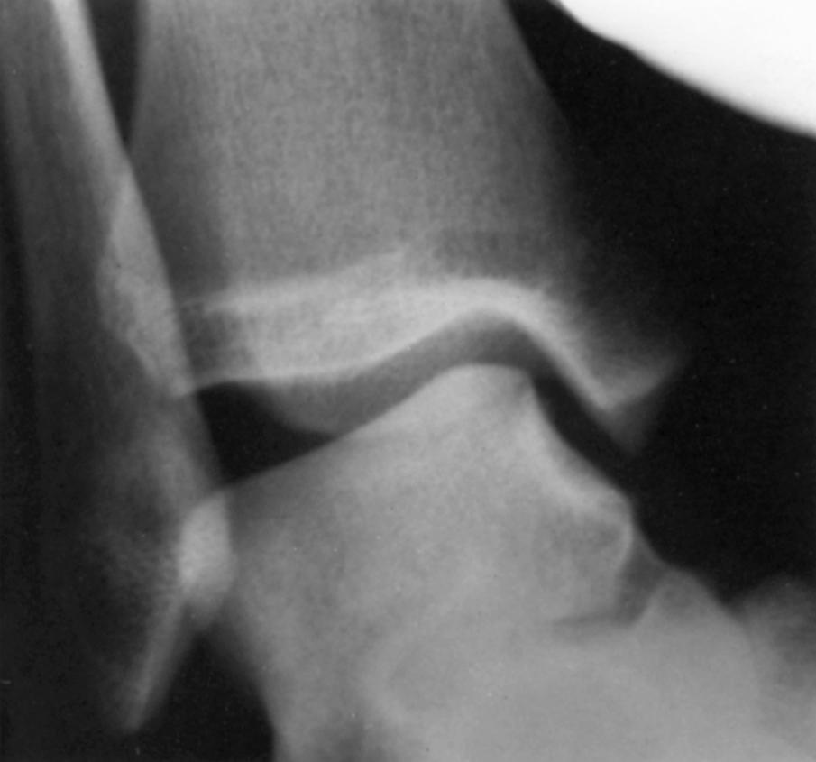 FIGURE 90.4, Positive inversion stress test.