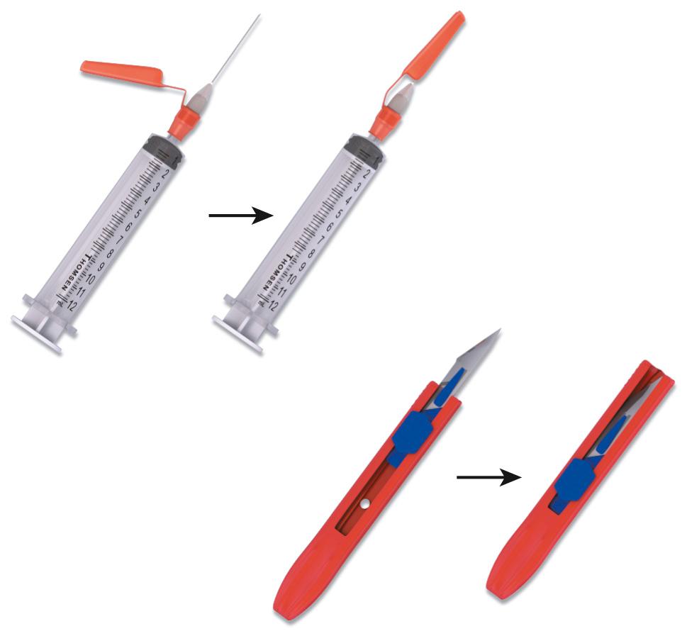 Figure 68.5, Using safety systems such as auto-recapping needles and retracting scalpels dramatically reduces percutaneous injuries to health care workers, and US federal law now mandates their use.