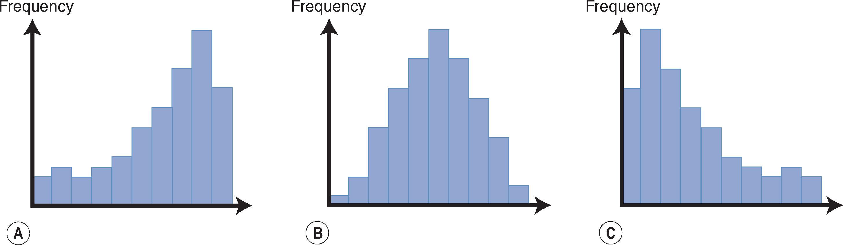 Fig. 14.3, Histograms representing skewness of data. (A) Negatively skewed (median > mean). (B) Normally distributed (median = mean = mode). (C) Positively skewed (median < mean).