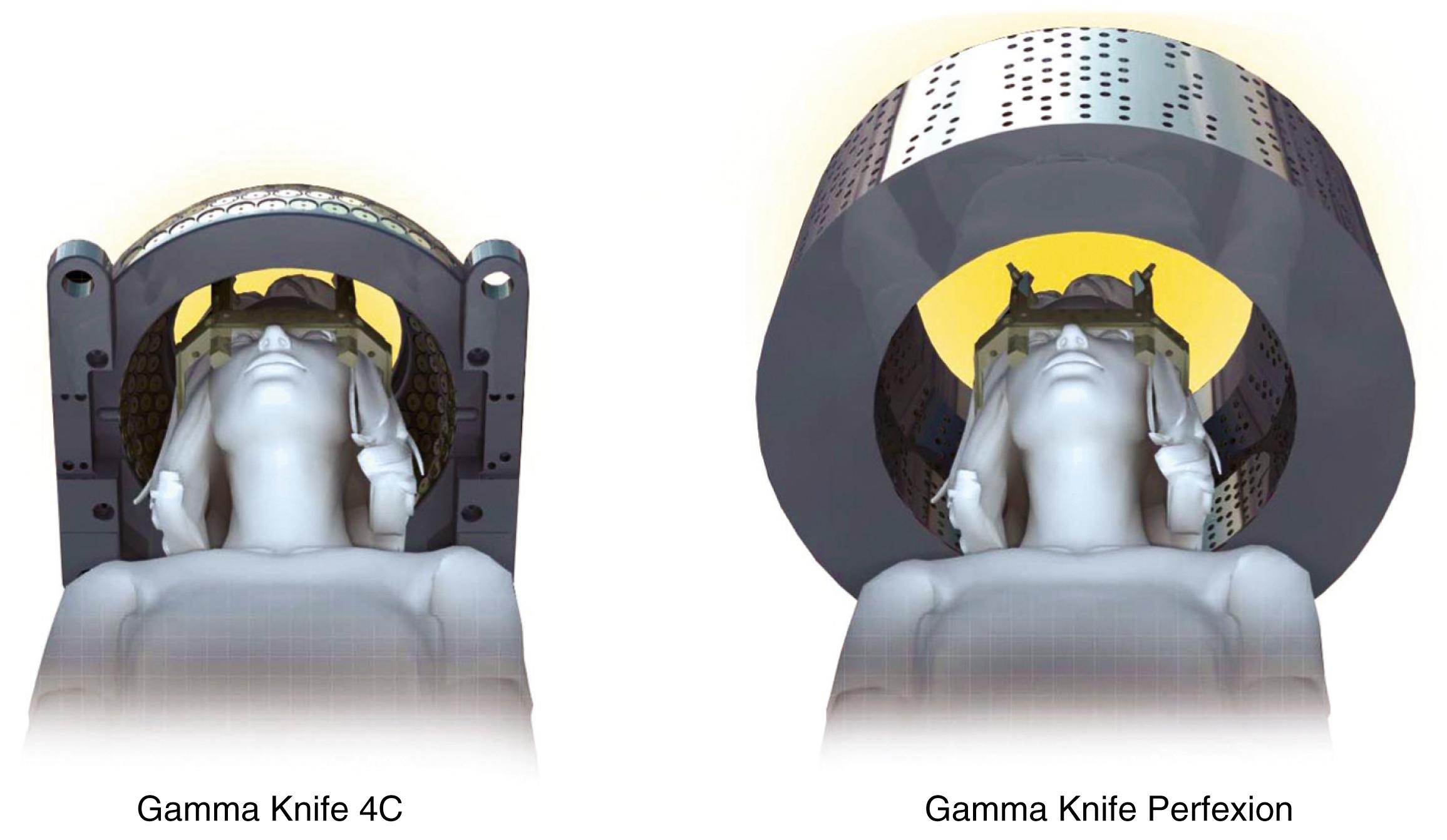 Fig. 59.2, Comparison of the collimator helmets used with the Gamma Knife model 4C and the Perfexion or Icon. Note the increased diameter and length of the Perfexion and Icon helmet, which allows treatment down to the level of the clavicles and treatment of patients with large heads or laterally located lesions.