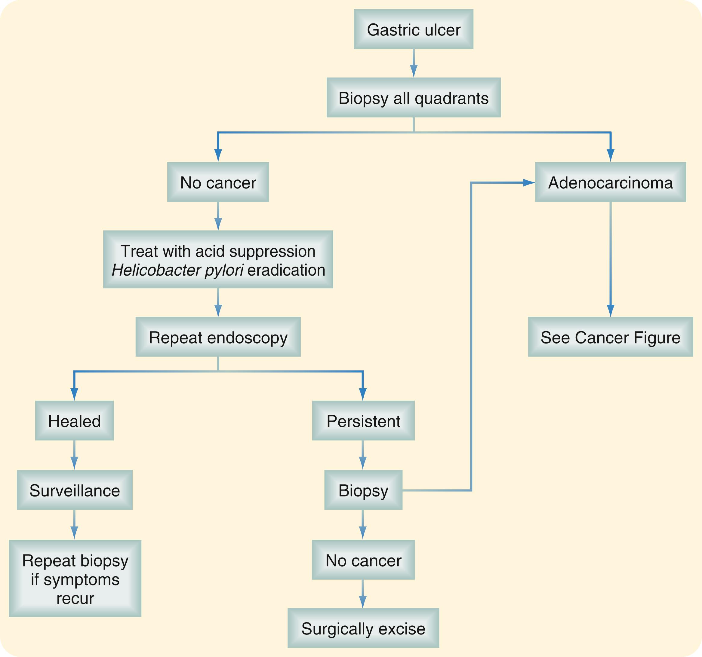 Fig. 49.9, Algorithm for evaluation, treatment, and surveillance of a patient with a gastric ulcer.