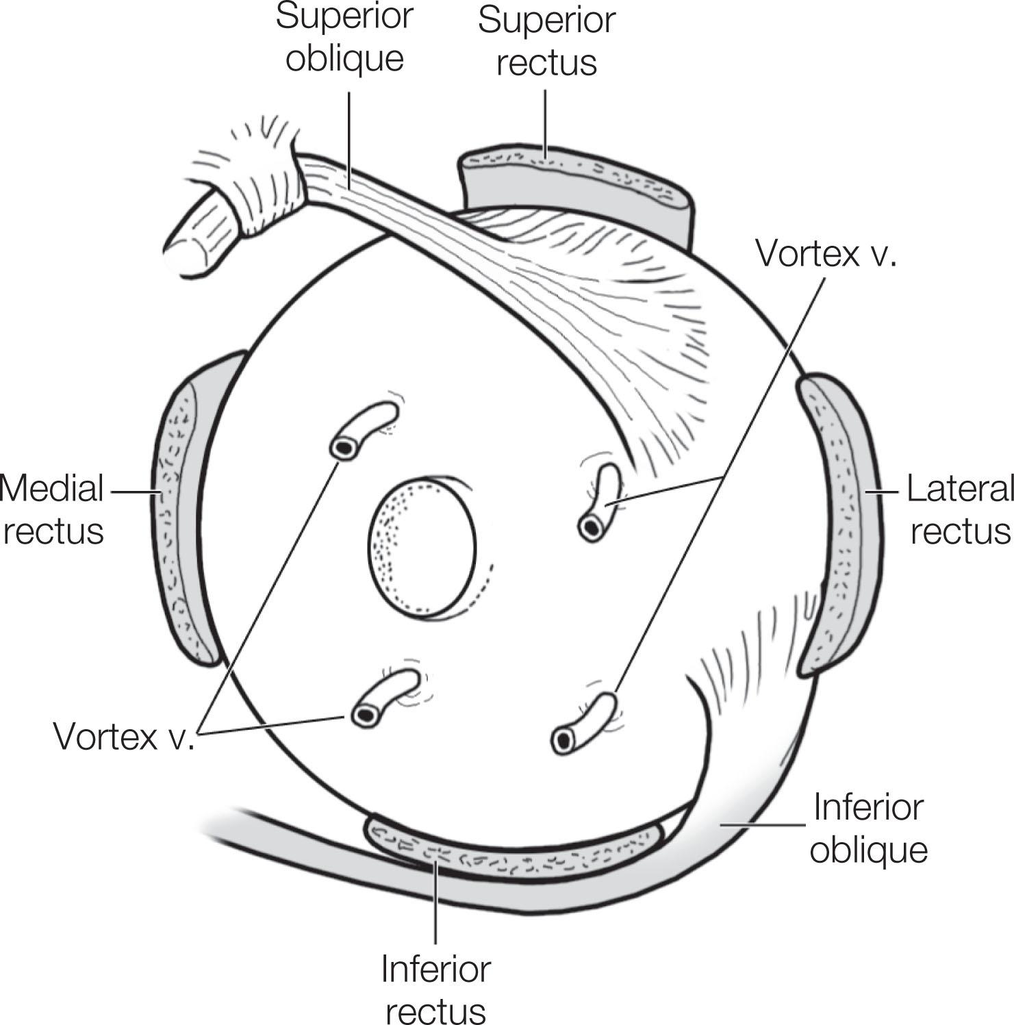 Fig. 88.6, Vortex veins as seen from the posterior aspect of the globe.