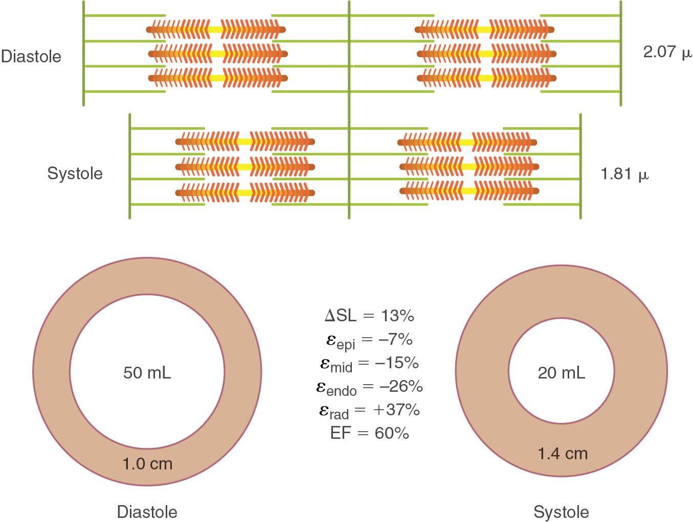 Fig. 1.3, Applied physiology of the transition from fiber shortening to ejection fraction (EF). A 10% change in fiber length translates to an epicardial strain (ε epi ) of −7%, midwall strain (ε mid ) of −15%, and endocardial strain (ε endo) of −26%, with a radial strain (ε rad ) of 37% and EF of 60%.