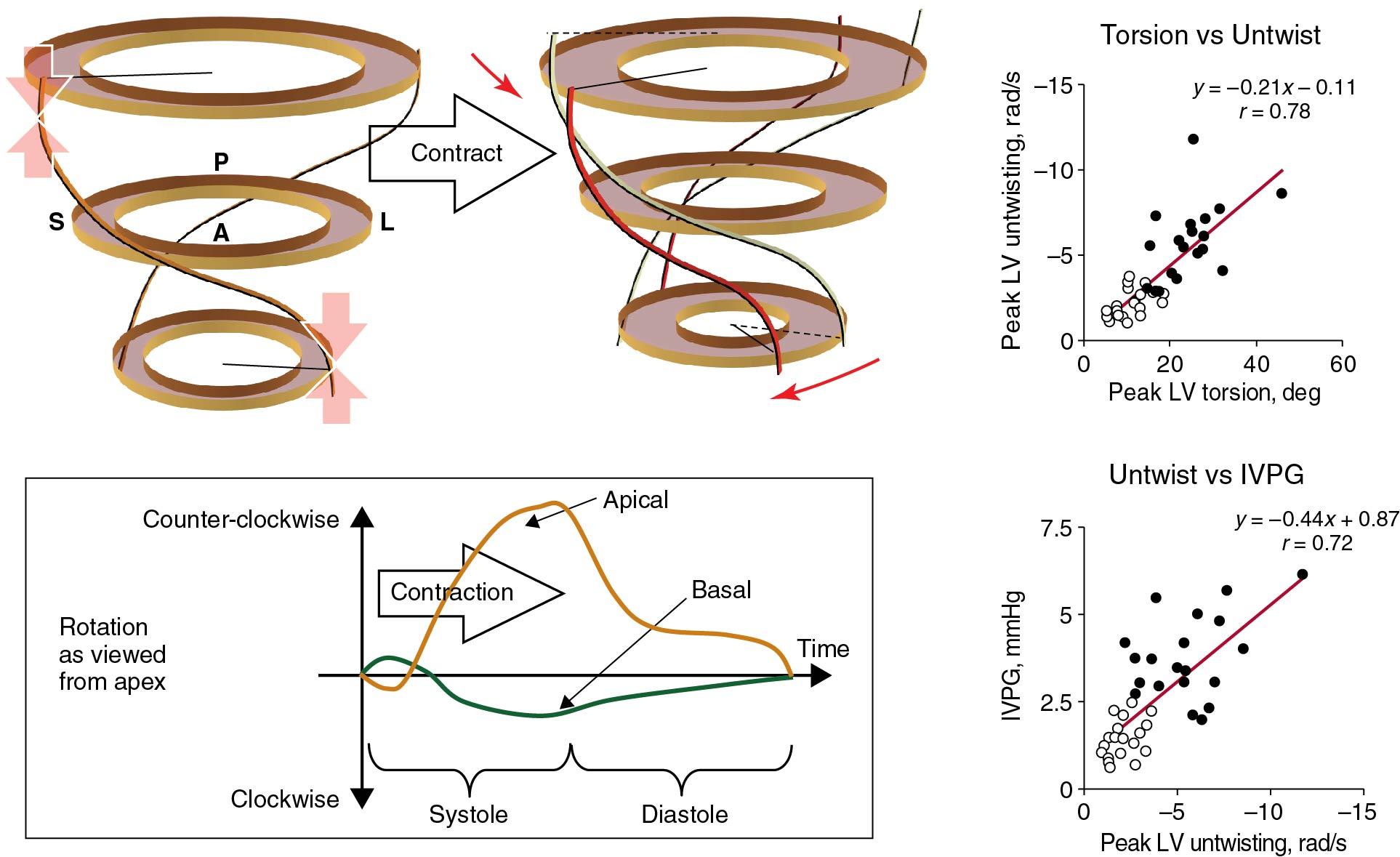 Fig. 1.4, Measurement of left ventricular (LV) twist and untwist with circumferential strain at different myocardial levels. Torsion correlates with untwist, which is a marker of LV suction.