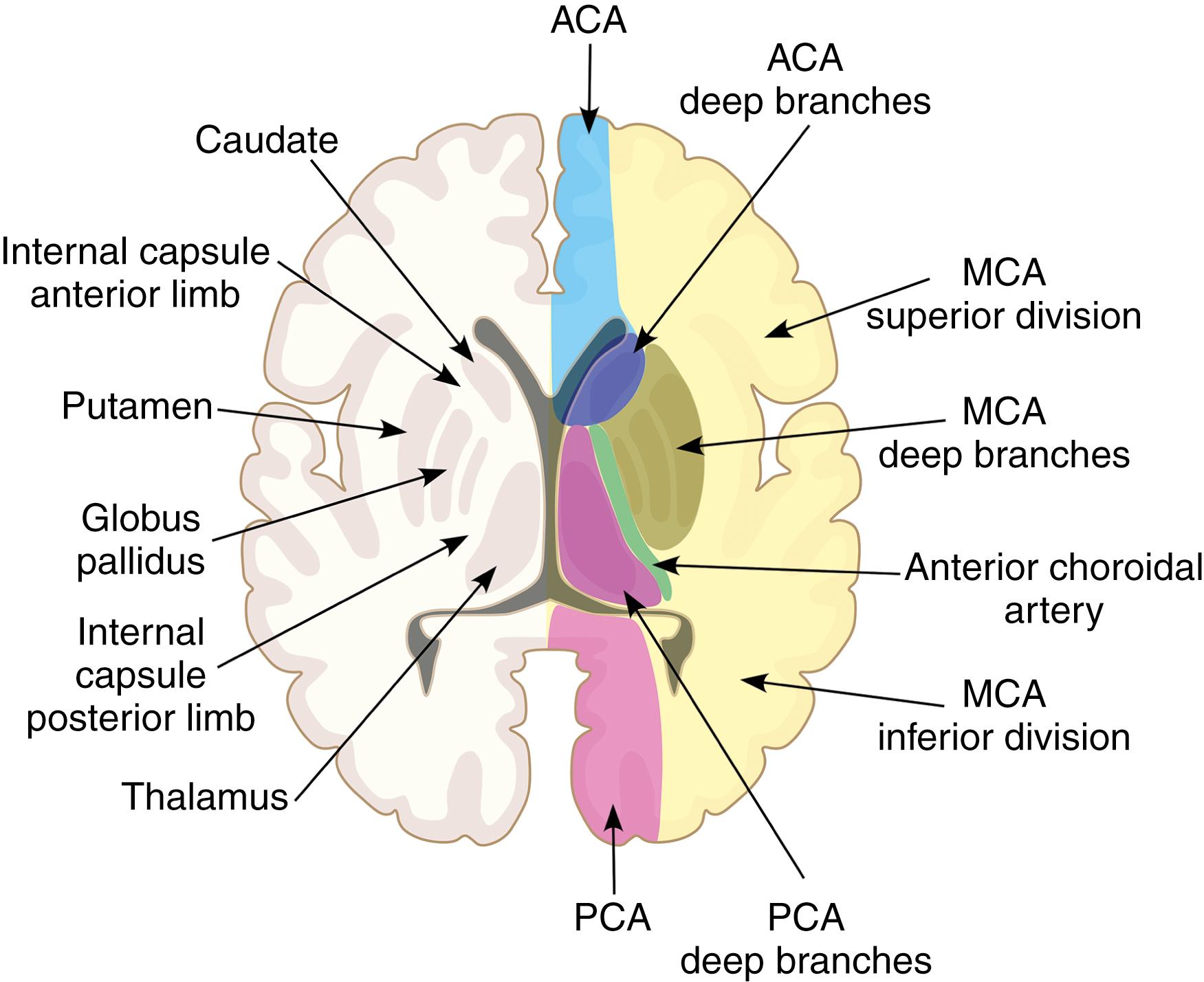 Fig. 37.3, Anatomic distribution of blood flow from major intracranial vessels in the cerebral hemispheres. ACA, anterior cerebral artery; MCA, middle cerebral artery; PCA, posterior cerebral artery.