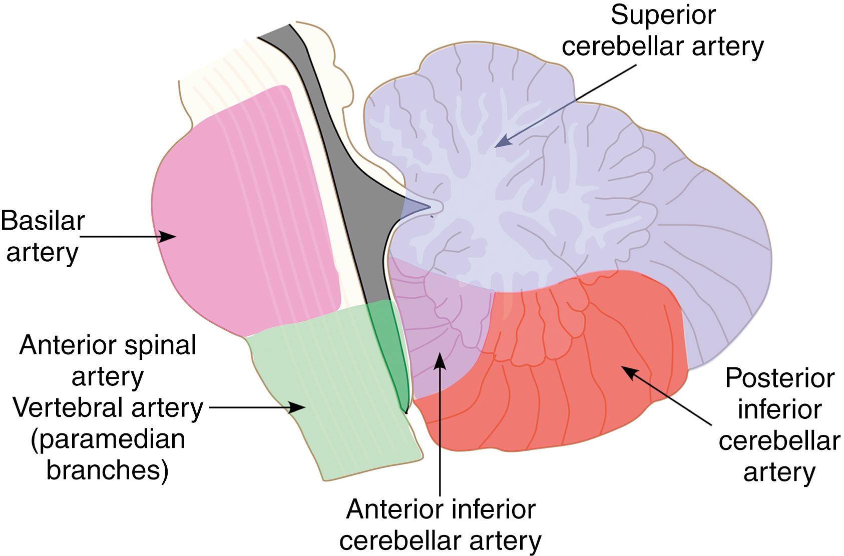 Fig. 37.4, Anatomic distribution of blood flow from major intracranial vessels in the cerebral hemispheres and infratentorial structures.