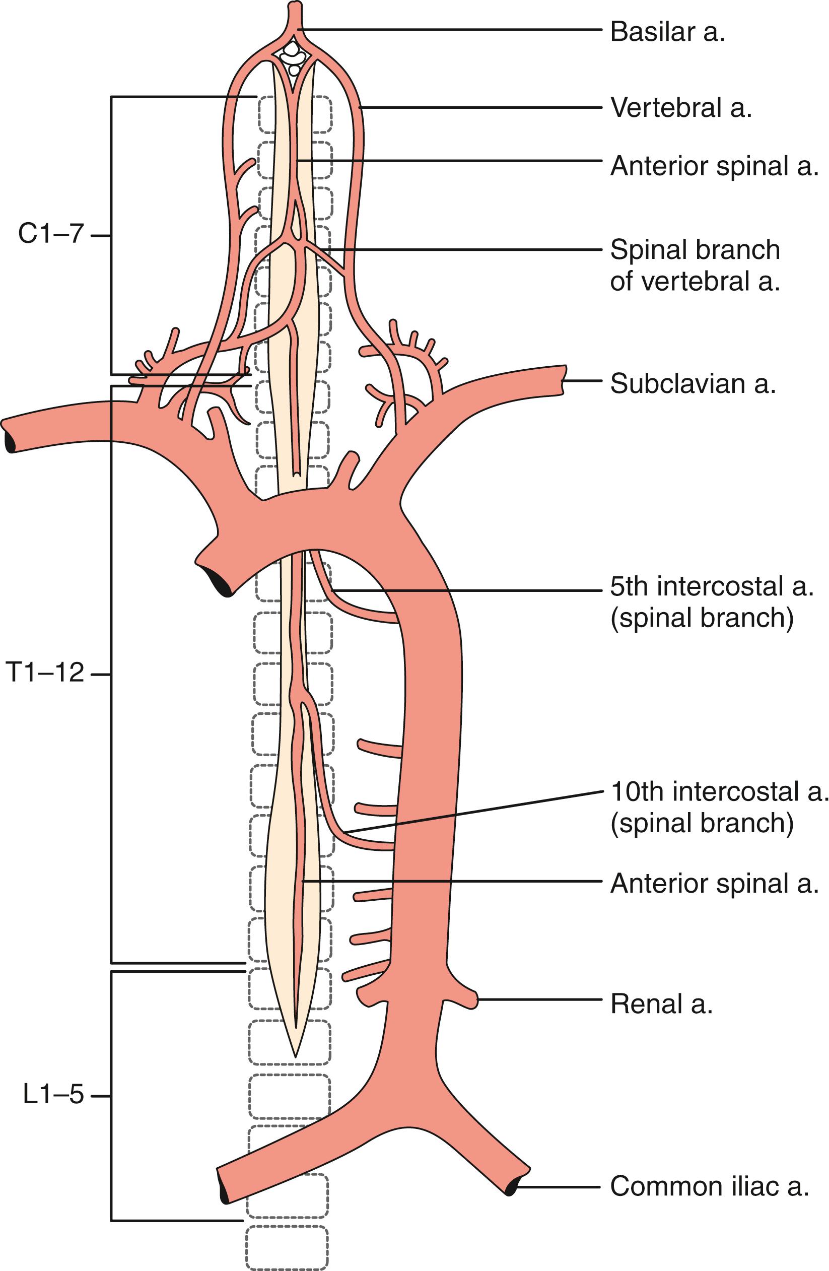 Fig. 31.1, Extrinsic vascular supply of the spinal cord. Schematic representation of the anterior spinal artery.