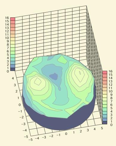 Fig. 22.2, Three-dimensional representation of topographical corneal oedema response to wearing of silicone hydrogel lenses under closed-eye conditions. To the right is the nasal direction, and the closer region is the inferior cornea. The vertical scale is the percentage increase in corneal thickness over baseline.