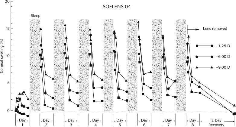 Fig. 22.5, Corneal swelling vs. time for 10 un-adapted subjects wearing Bausch & Lomb Soflens 04 series hydrogel contact lenses continuously for a period of 1 week. All subjects wore − 1.25 D lenses on one eye; half wore − 6.00 D lenses, and half wore − 9.00 D lenses on the other eye.
