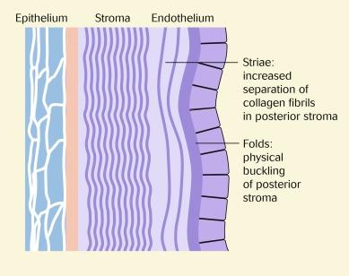 Fig. 22.7, Location of striae and folds.