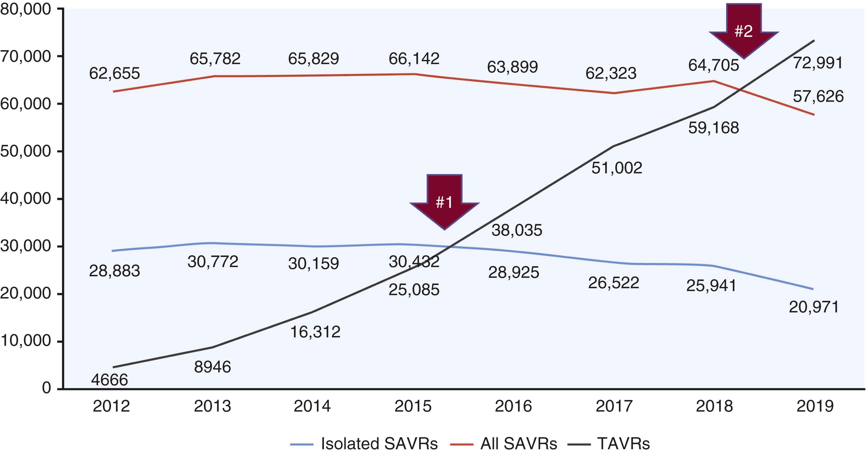 Figure 23.1, Annual volumes of transcatheter aortic valve replacement (TAVR) and surgical aortic valve replacement (SAVR) . The volume of isolated SAVR (blue line) , all forms of SAVR (SAVR+ coronary artery bypass grafting, Bentall procedures, and SAVR plus other surgical procedures, red line ), and TAVR (gray line) are shown from 2012 until 2018. The two red arrows denote transition points: Arrow #1: the volume of TAVR first exceeded isolated SAVR between 2015 and 2016 with the beginning of a decline in isolated SAVR volume that in 2019 was 9801 fewer cases than the peak in 2013. TAVR in intermediate-risk patients was approved in 2016. Arrow #2: volume of TAVR exceeded all forms of SAVR between 2018 and 2019 with a 1-year decline in 2019 from 2018 of 7079 for all types of SAVR cases. TAVR for low-risk patients was approved in 2019. Source of SAVR data is the Society of Thoracic Surgeons National Database.