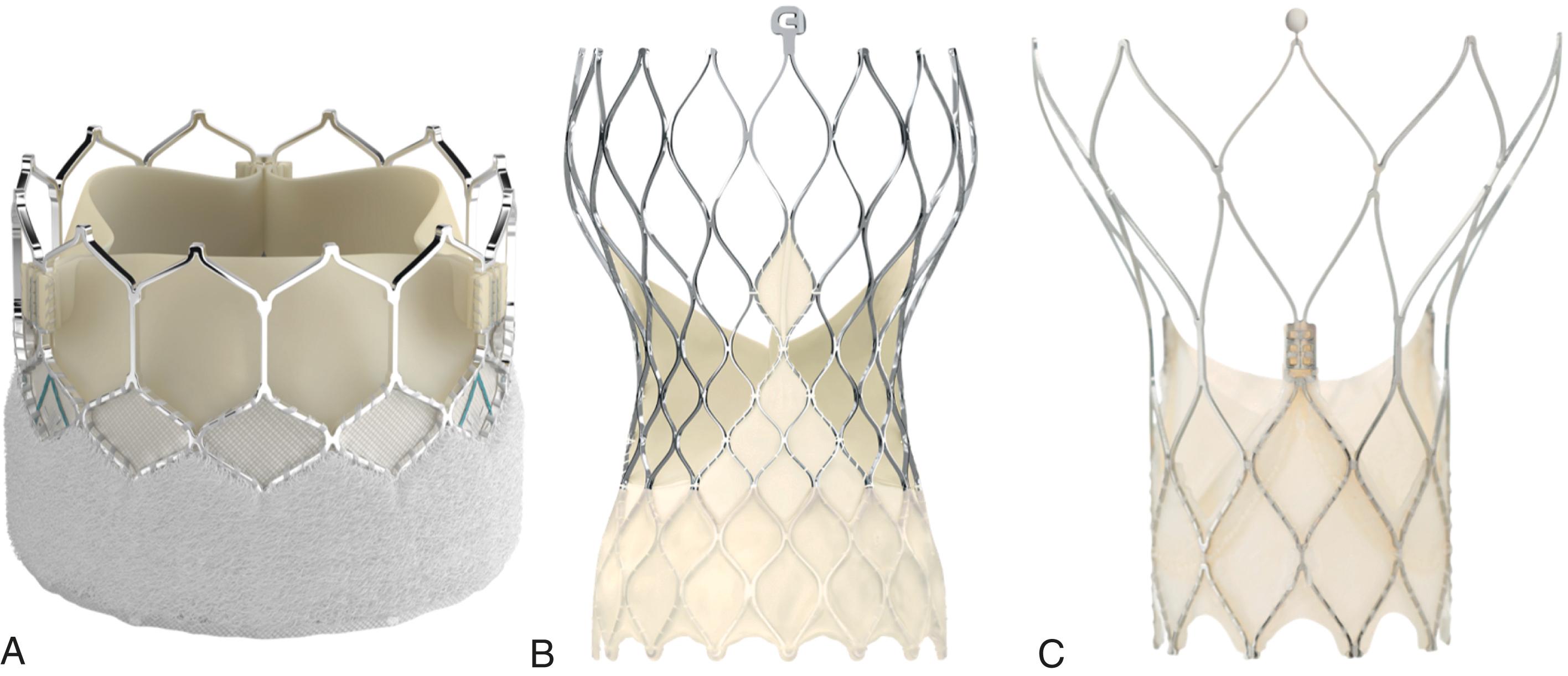 Figure 23.2, Transcatheter aortic valve implantation devices. (A) The SAPIEN 3 transcatheter heart valve, (B) the Evolut Pro+ valve, and (C) Portico valve are shown.