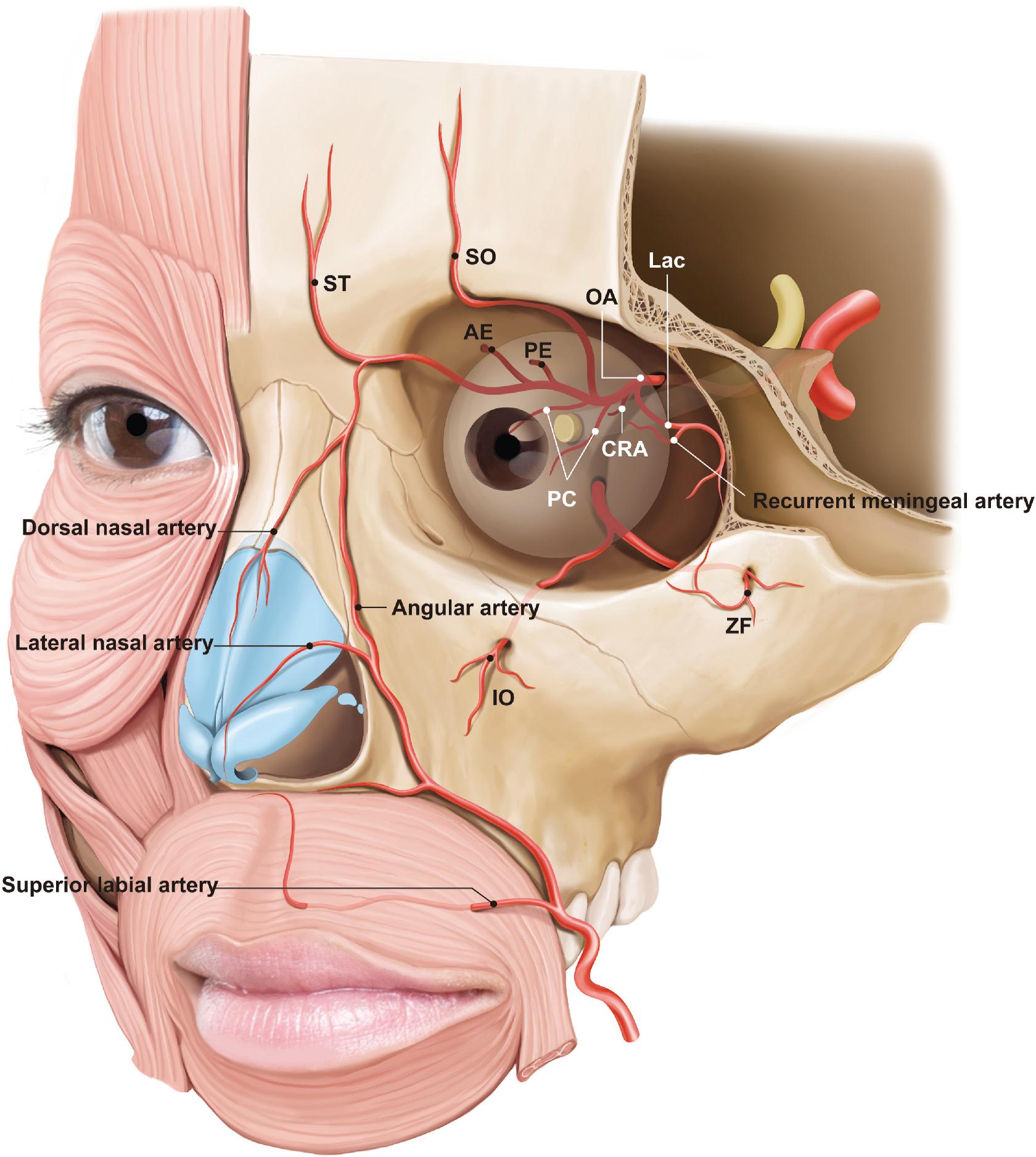 Fig. 36.1, The arterial supply of the face consists of vessels from both the internal and external carotid arteries. Of note is the communication between these two systems, which can lead to the devastating consequences of embolic events. AE , Anterior ethmoidal artery; CRA , central retinal artery; IO , infraorbital artery; LC , lacrimal artery; OA , ophthalmic artery; PC , posterior ciliary artery; PE , posterior ethmoidal artery; SO , supraorbital artery; ST , supratorchlear artery; ZF , zygomaticofacial artery.