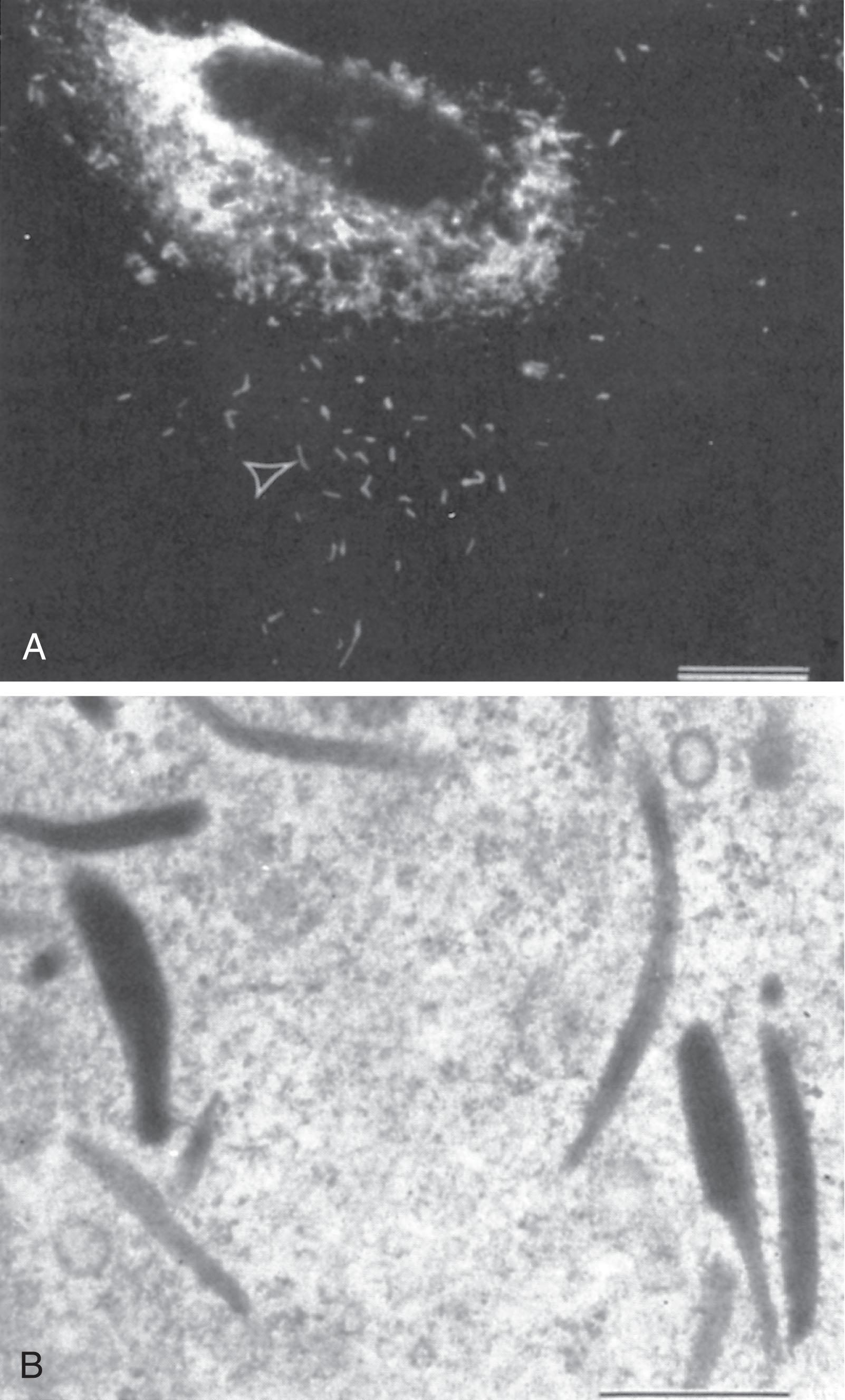 Figure 133.3, WEIBEL-PALADE BODIES OF ENDOTHELIAL CELLS.