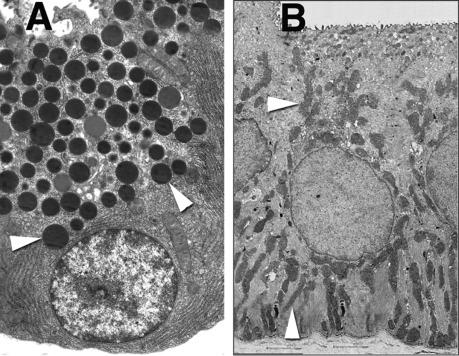 Fig. 39.1, Major cell types of the exocrine pancreas. (A) Acinar cell electron-dense zymogen granules in its apical region ( arrowheads ). (B) Duct cell with numerous mitochondria ( arrowheads ).