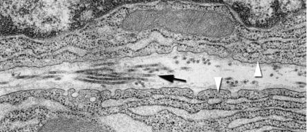 Fig. 39.5, Transmission electron microscopy demonstrating the basal regions of adjacent acinar cells ( arrowheads ) with their associated basement membranes and intervening collagen fibrils ( arrow ) in the extracellular space.