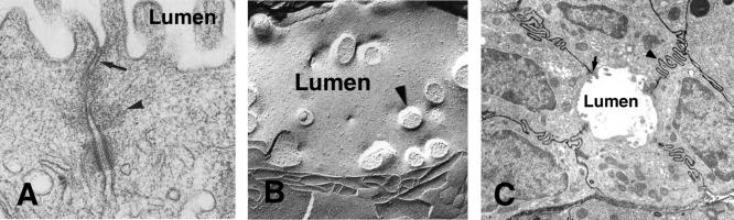 Fig. 39.6, Pancreatic junctional complexes are localized to the lateral membrane of the pancreatic acinar cell. (A) Transmission electron microscopy demonstrating junctional complexes between two adjacent cells including a tight junction ( arrow ), adherens zonule ( arrowhead ), and a desmosome just below. Note the actin filaments in the cytoplasm associated with the tight and adhering zonules; intermediate filaments are associated with desmosomes. (B) Freeze-fracture image showing sealing strands in tight junctions ( arrows ) and microvilli that project into the lumen ( arrowhead ). (C) Transmission electron microscopy demonstrating junctional region of adjacent acinar cells following an intravenous injection of lanthanum. Note that the electron-dense marker ( black ) moves up between the lateral membranes ( arrowhead ) but is stopped from entering the lumen (DL) in the region of the tight junction ( arrow ).