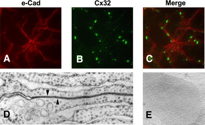 Fig. 39.7, Immunolocalization of acinar cell plasma membrane (A) with e-cadherin (e-Cad), gap junctions with connexon 32 (Cx32), and a merge (C) of A, B. (D) Transmission electron microscopy demonstrating a gap junction ( arrowhead ) in the lateral membrane. (E) Freeze-fracture image demonstrating a patch of intramembrane participle in the basolateral membrane typical of a gap junction.